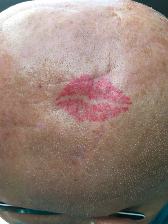 kiss lips